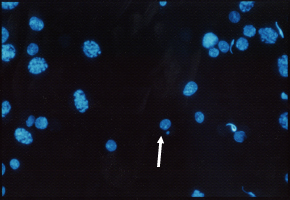 小核試験（精巣）の写真